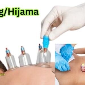 Cupping/Hijama