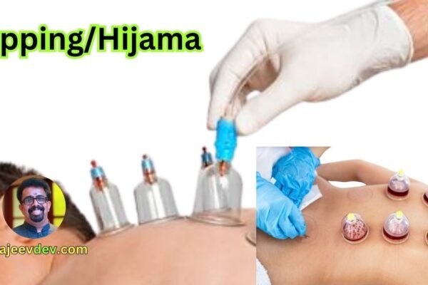 Cupping/Hijama