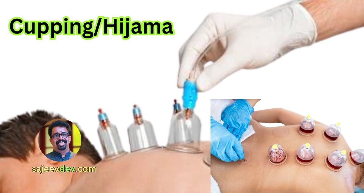 Cupping/Hijama