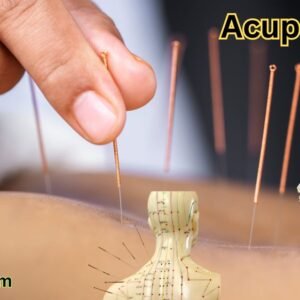 Acupuncture