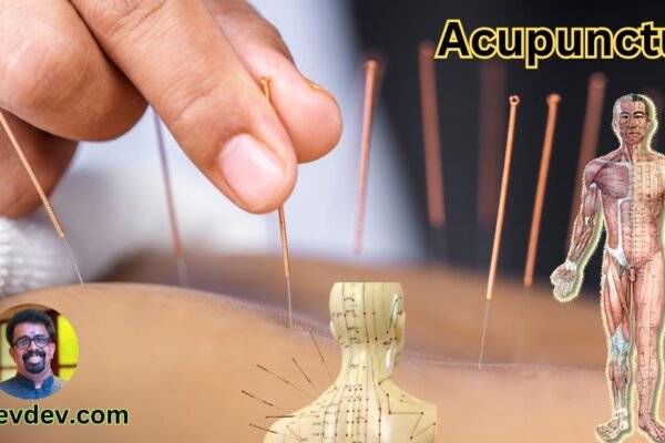 Acupuncture