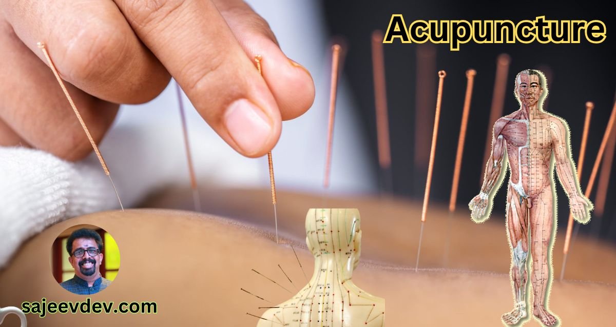 Acupuncture