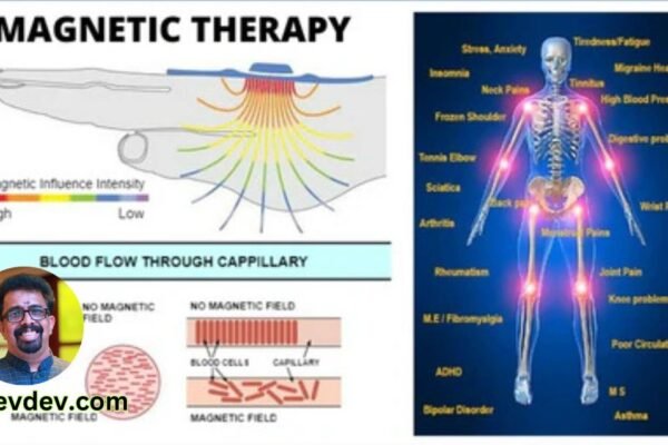 The Healing Power of Magnetic Therapy An Overview of Benefits and Controversies