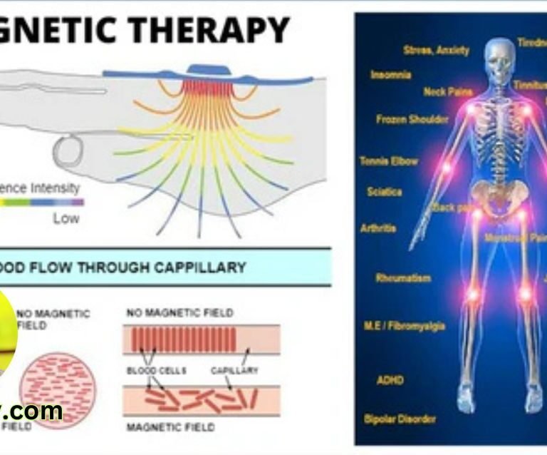 The Healing Power of Magnetic Therapy An Overview of Benefits and Controversies